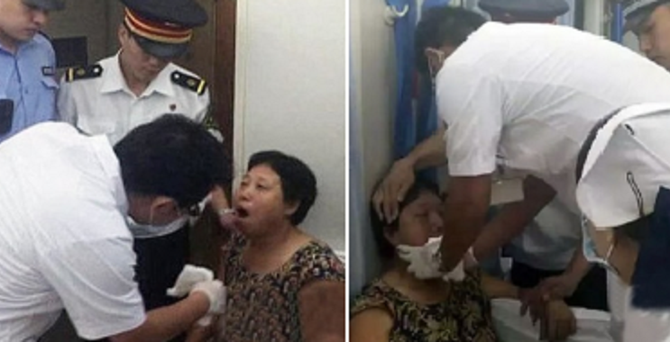 Chinese Woman Dislocates Her Jaw From Laughing Too Much - World Of Buzz 4