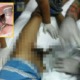 Malaysian Man Suffered 12 Hours Of Pain After Penis Ring Could Not Come Off - World Of Buzz 4
