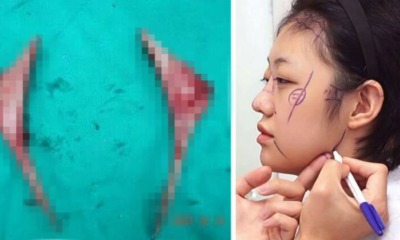 South Korean Clinic Displays Two Massive Glass Containers Of Jaw Bone Shavings - World Of Buzz