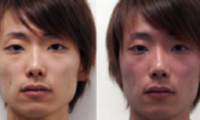 Drinking Alcohol Turns Some People Red Quickly, Here's the Ugly Truth - World Of Buzz 4