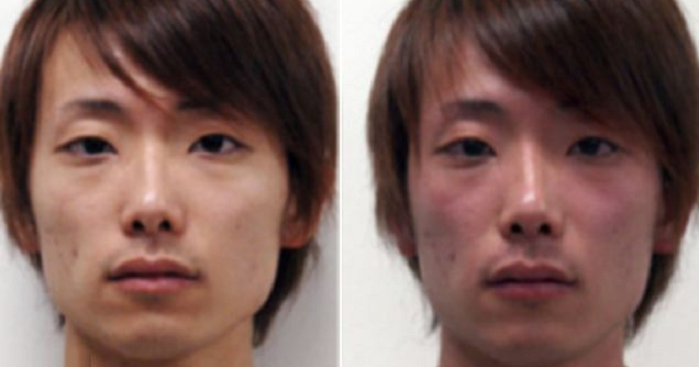 Drinking Alcohol Turns Some People Red Quickly, Here's the Ugly Truth - World Of Buzz 4