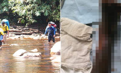 Malaysian Mountain Guide Shares Trembling Moments of His Members Infected with Flash-eating Bacteria - World Of Buzz 1