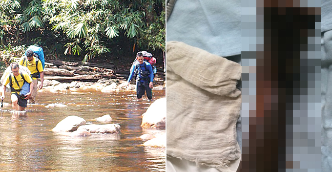 Malaysian Mountain Guide Shares Trembling Moments of His Members Infected with Flash-eating Bacteria - World Of Buzz 1