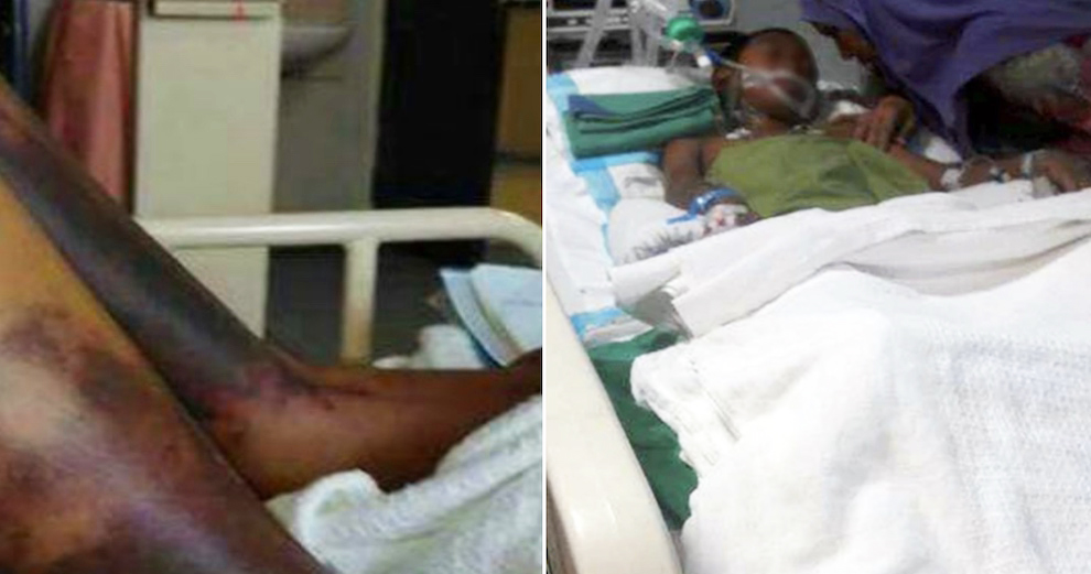 Primary School Student May Lose Right Arm, Johor Permaisuri Urges Prompt Action - World Of Buzz 2