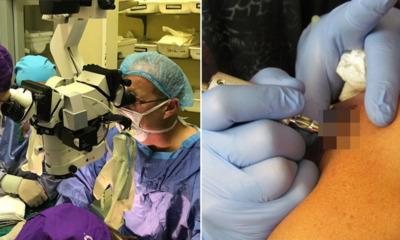 Black Man Undergoes Penis Transplant, but the Donor is a White Guy - World Of Buzz