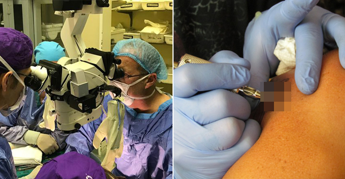 Black Man Undergoes Penis Transplant, but the Donor is a White Guy - World Of Buzz