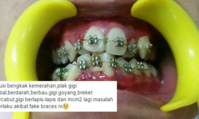 Malaysian Dentist Shocked to Find His Patient Wearing Fake Braces - World Of Buzz