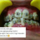 Malaysian Dentist Shocked to Find His Patient Wearing Fake Braces - World Of Buzz