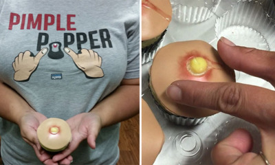 Netizens Getting Mind-blown by These Pimple Popping Cupcakes - World Of Buzz