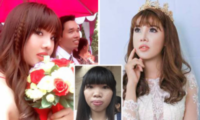Ugly Vietnamese Lady Deemed Undesirable Transforms into Gorgeous Lady and Found Rich Husband - World Of Buzz 2