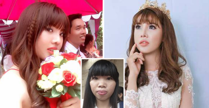 Ugly Vietnamese Lady Deemed Undesirable Transforms into Gorgeous Lady and Found Rich Husband - World Of Buzz 2