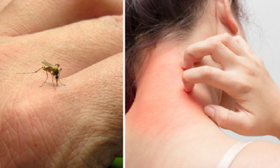 12 Things Malaysians Need to Know About Mosquitoes to Prep for Dengue Season - World Of Buzz 15