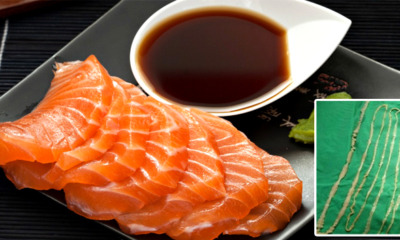 Doctor Removes 2.6 Metres Long Tapeworm From Girl Who Loves Sashimi - World Of Buzz