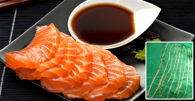 Doctor Removes 2.6 Metres Long Tapeworm From Girl Who Loves Sashimi - World Of Buzz