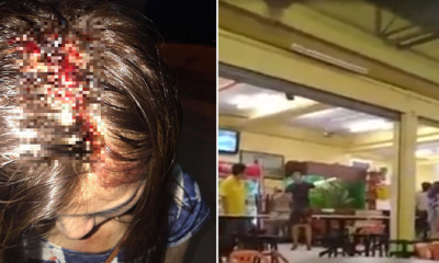 Malaysian Girl Accuses Restaurant Owner of Injuring Her Head, But Here's the Twist - World Of Buzz 5