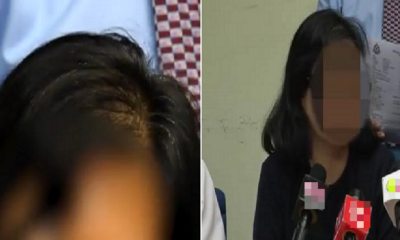 Malaysian Lady Gets Conned Out of RM300,000 for Hair Loss Treatment - World Of Buzz 3