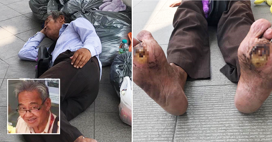 'Soft Toy' Uncle's Health Deteriorates, Kind Netizens Rally Around to Help - World Of Buzz 6