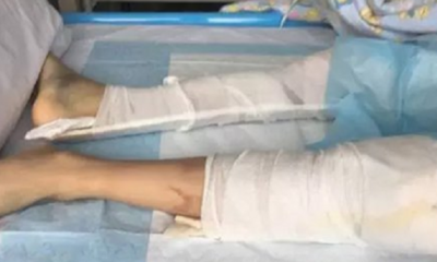 Teen Wakes Up in Hospital After Jumping Off 4th Floor, Wants to Log in Game Account - World Of Buzz