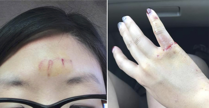 "The Inspector Said There are AT LEAST 8 Cases of Snatch Theft a Day in Bangsar" - World Of Buzz