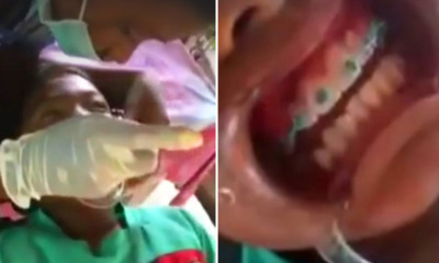 Video of Thai Schoolboy Installing Braces on his Schoolmates Goes Viral - World Of Buzz 2