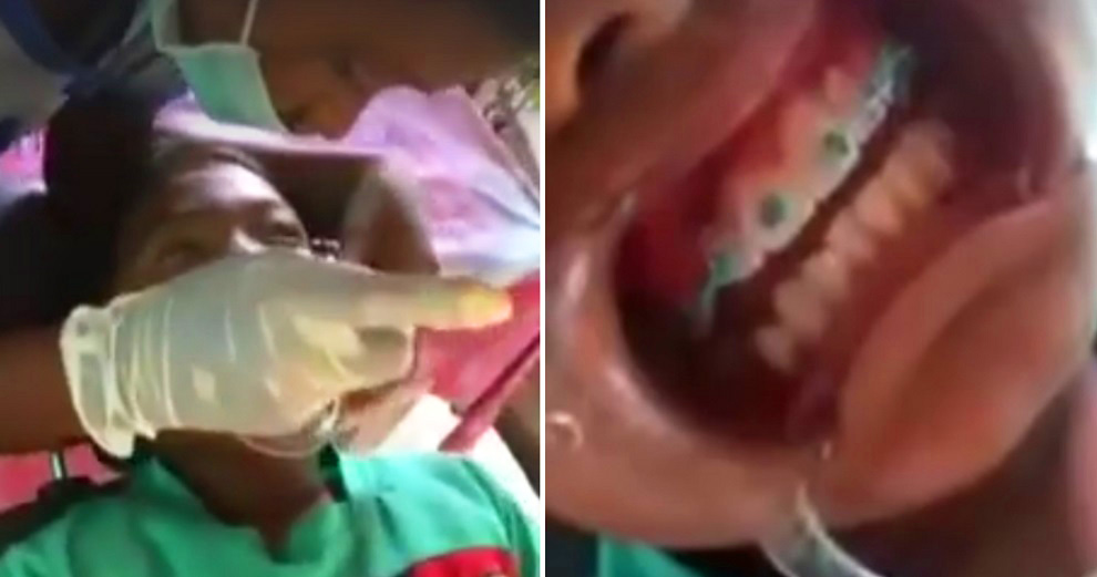 Video of Thai Schoolboy Installing Braces on his Schoolmates Goes Viral - World Of Buzz 2