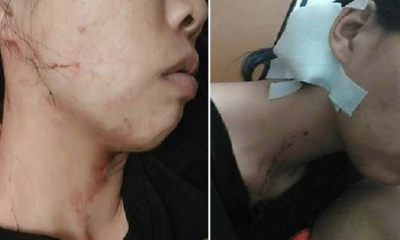 Woman Gets Robbed and Kicked by Fake Policemen in Johor, Requires 8 Stitches - World Of Buzz