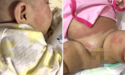 Malaysian Baby Infected With Influenza A Misdiagnosed for Allergy in a Hospital in KL - World Of Buzz