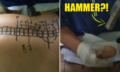 Malaysian "Doctor" Shares Unorthodox Way of Curing Slipped Discs, Shocks the World - World Of Buzz 2