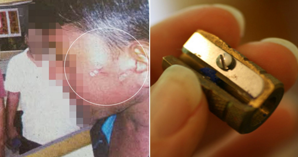 Malaysian Teacher Placed Heated Metal Sharpener on Student's Cheek as Punishment - World Of Buzz 3