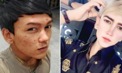 Malaysia's Real-Life 'Anime Character' Upset Over Negative Comments About His Appearance - World Of Buzz 4