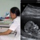 Woman Forced to Have 4 Abortions in 1 Year Because Babies Were Girls, Passes Away - World Of Buzz 3
