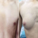 Doctors Suspect Male Teen's A Cup Right Breast Caused by Excessive Fast Food - World Of Buzz 4