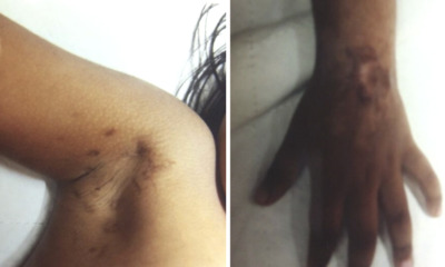 Malaysian Nurse Adopts Two Girls Solely For Their Monthly Aid And Sexually Abuses Them - World Of Buzz