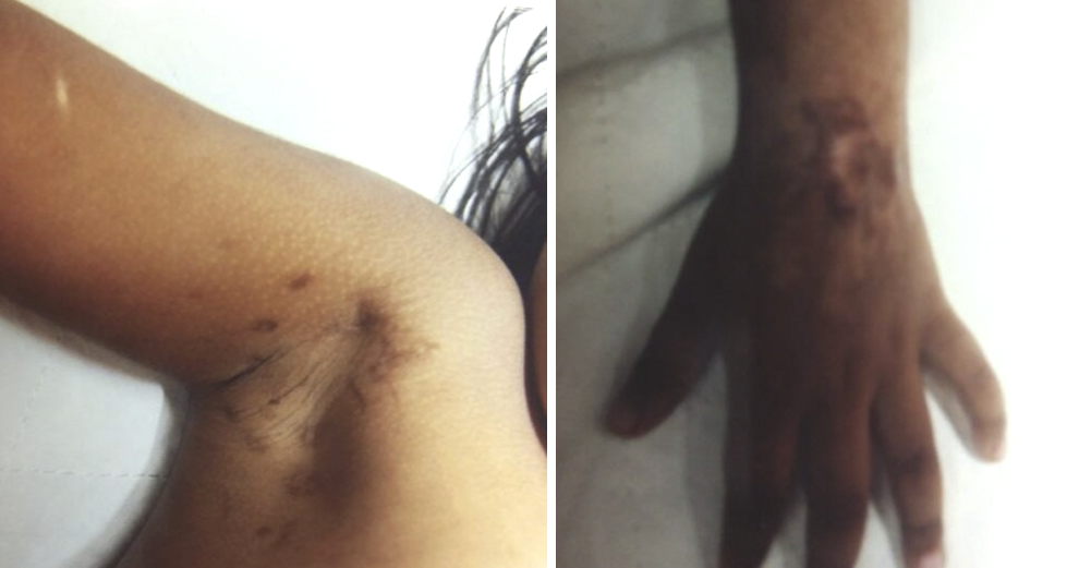 Malaysian Nurse Adopts Two Girls Solely For Their Monthly Aid And Sexually Abuses Them - World Of Buzz