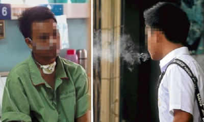 Malaysian Started Smoking at 17, Now One of the Youngest Oral Cancer Patients - World Of Buzz 7