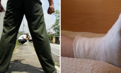 M'sian Student Breaks Classmate's Leg After Getting Angry Over Offensive Jokes - World Of Buzz 1
