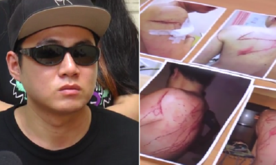 Tourist Meets WeChat Friend in Puchong, Gets Attacked, Robbed and Stripped - World Of Buzz 7