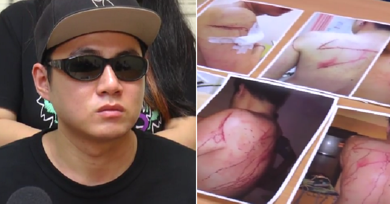 Tourist Meets WeChat Friend in Puchong, Gets Attacked, Robbed and Stripped - World Of Buzz 7