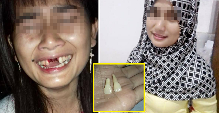 Man Couldn't Stand Wife's Nagging, Kicks Her in the Face Until Teeth Fall Out - World Of Buzz