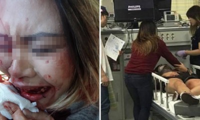 Indonesian Student Brutally Beaten up By Nightclub Bouncer, Accuses Him of Racism - World Of Buzz 4