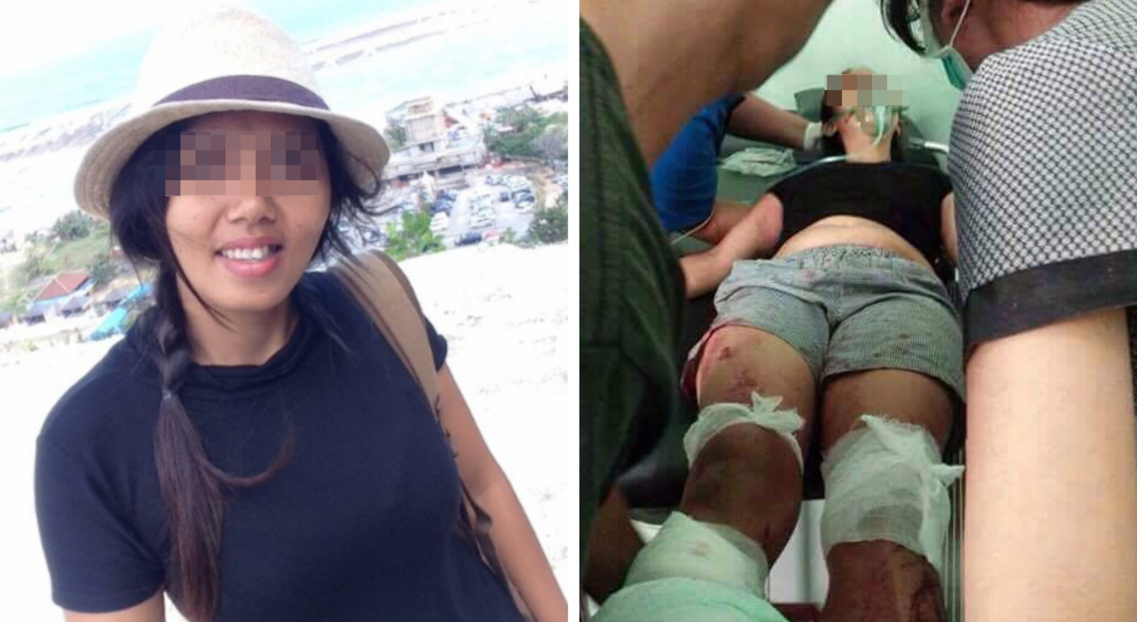 Man Chops Wife's Foot Off in Front of Children, Immediately Drives Her to Clinic - World Of Buzz 6