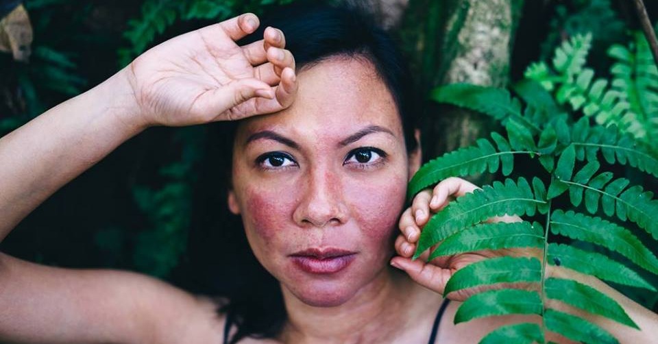 This Malaysian is Living Proof That Your 'Flaws' Don't Determine Your Success - WORLD OF BUZZ
