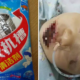 Toddler Sustains Serious Injuries on Mouth and Body After Accidentally Eating Washing Powder - World Of Buzz 2