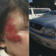 Brave M'sian Boy Fights With Carjacker After His 2 Sisters Jump Off the Moving Truck - WORLD OF BUZZ