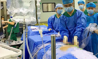 Doctor Removes 9 Kidney Stones from 9yo Boy, Suspect Milk Powder is the Cause - WORLD OF BUZZ 3