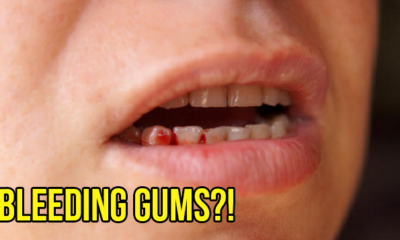 Here's What Can Happen If You're Someone Who Doesn't Like Brushing Your Teeth - WORLD OF BUZZ 15