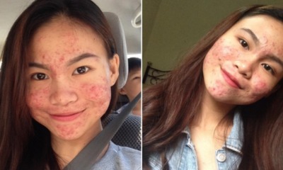 This Insta-Famous Malaysian is Inspiring Everyone with Her Natural Skin - WORLD OF BUZZ 9