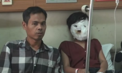 Woman Allegedly Forced 11-Year-Old Granddaughter's Face into Pot of Hot Oil - WORLD OF BUZZ 2