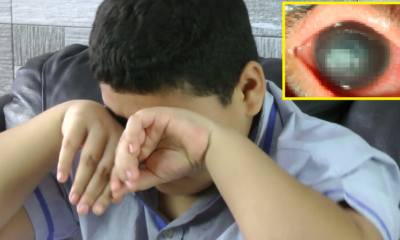 Young School Boy Suffers from Near Blindness After Corneal Scratch Gets Infected - WORLD OF BUZZ 3