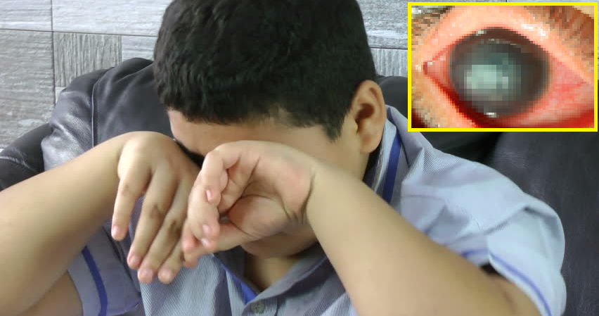Young School Boy Suffers from Near Blindness After Corneal Scratch Gets Infected - WORLD OF BUZZ 3